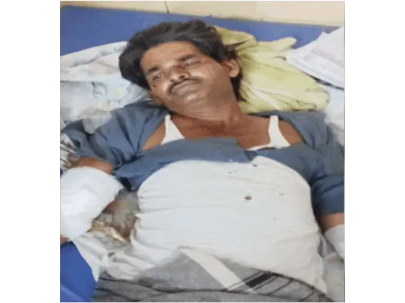 વાડીએ છેડા ફીટ કરતા ઇલેક્ટ્રિક કરંટ લાગ્યો