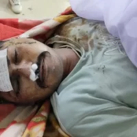 વાળ કપાવવા જતા ટ્રક હડફેટે અકસ્માતમાં મૃત્યુ