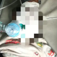 રાતીદેવરીમાં ૮ માસના બાળકને ઈલેક્ટ્રિક શૉક લાગ્યો