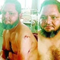 દીઘલીયામાં છરીથી સરકા કરવાની ફરિયાદ નોંધાઈ