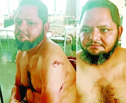 ભત્રીજાને છરી કેમ બતાવી હતી? પૂછનારને છરી મારી