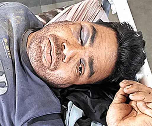 ભરડીયામાં બનેલો બનાવ: ભારે પવનથી પડી જતાં ઇજા