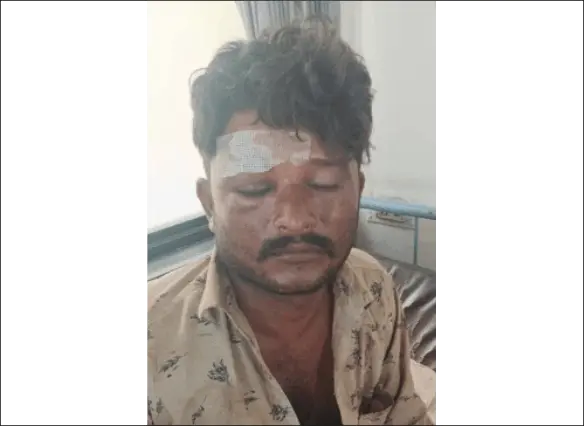 માટેલ રોડ પર ભંગારના ધંધાર્થી ઉપર હુમલો