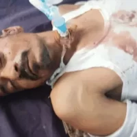 પંચાસીયા પાસે અકસ્માતમાં મિસ્ત્રીનું મરણ