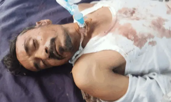પંચાસીયા પાસે અકસ્માતમાં મિસ્ત્રીનું મરણ