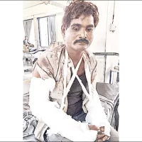 મજૂરીના પૈસા માંગતા હાથ ભાંગી નાખ્યા