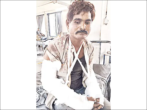મજૂરીના પૈસા માંગતા હાથ ભાંગી નાખ્યા